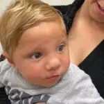 ניתוח חך שסוע