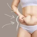 בטן אחרי לידה