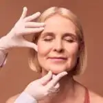 החלמה ממתיחת פנים