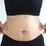 ניתוח שאיבת שומן