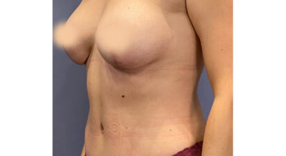 מאמי מייקאובר - after treatment