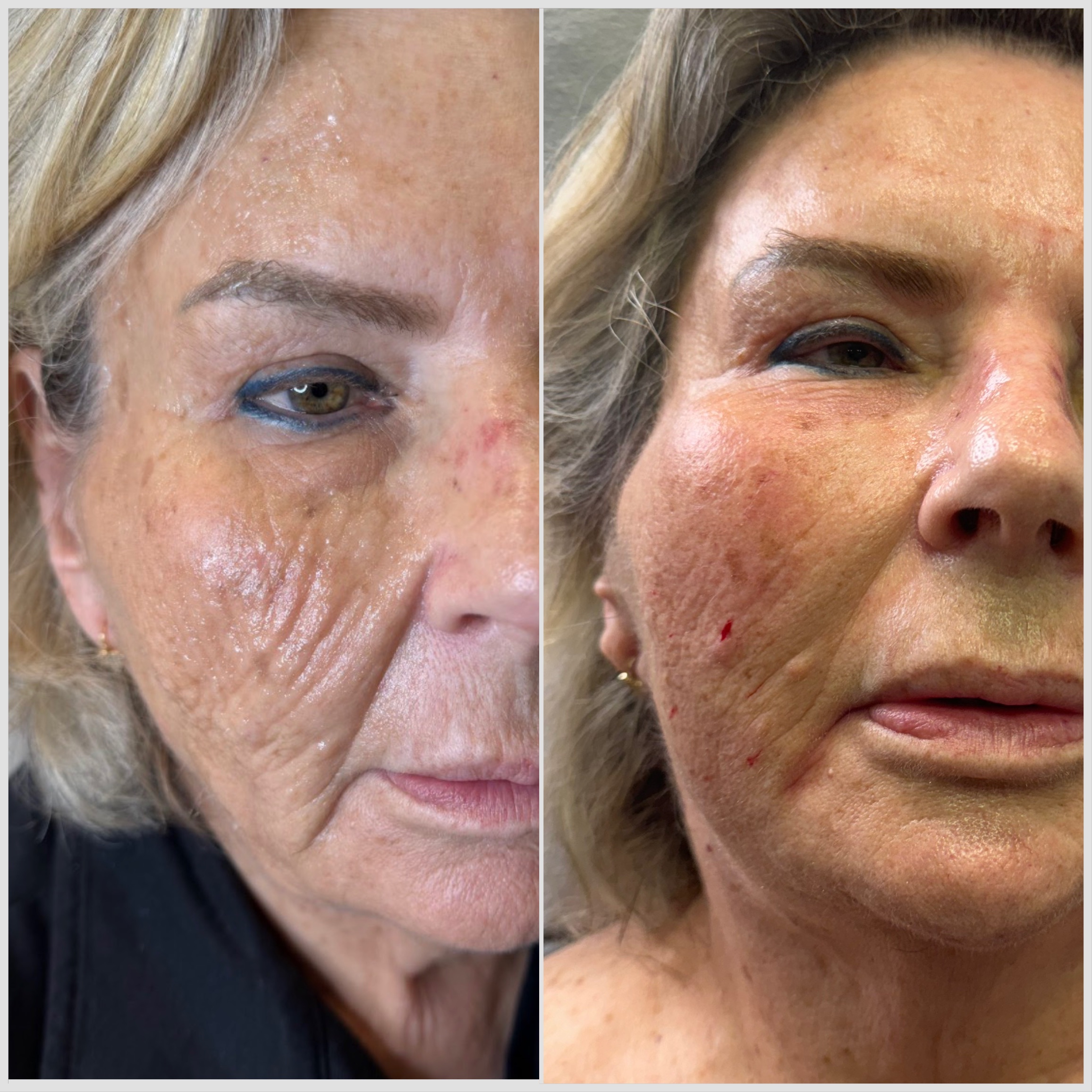 אנטי אייג'יינג וביוטי